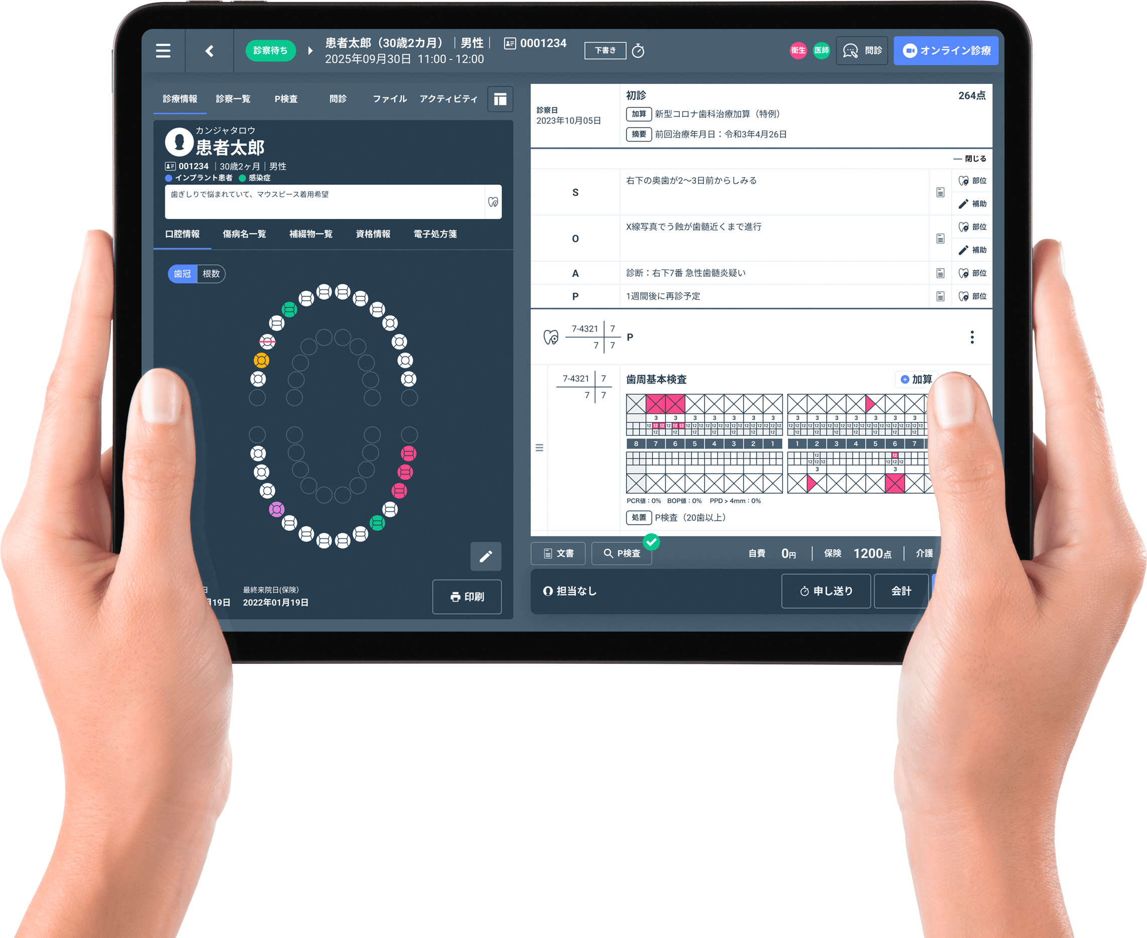 Dentisカルテ画面イメージ