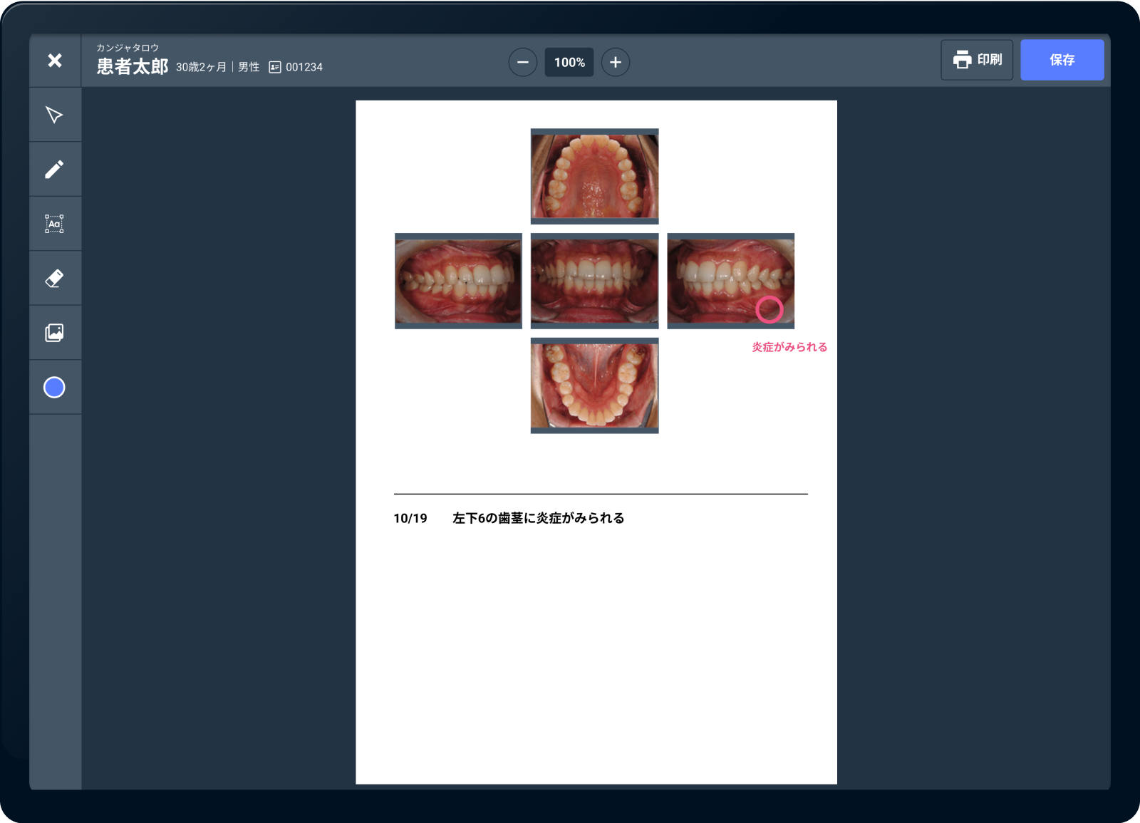 手書きメモ画面